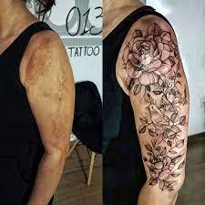 tatuagem-reparadora-promete-ajudar-pessoas-com-cicatrizes